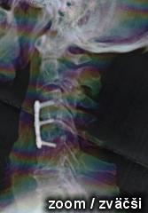 SLY X-RAY